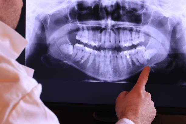 Best Emergency Care for Gum Disease in Logan, WV